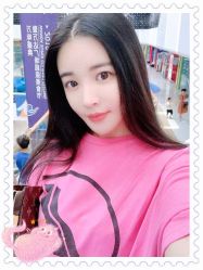 体验后-大麦微针植发全国连锁