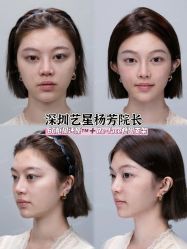 -深圳艺星医疗美容医院