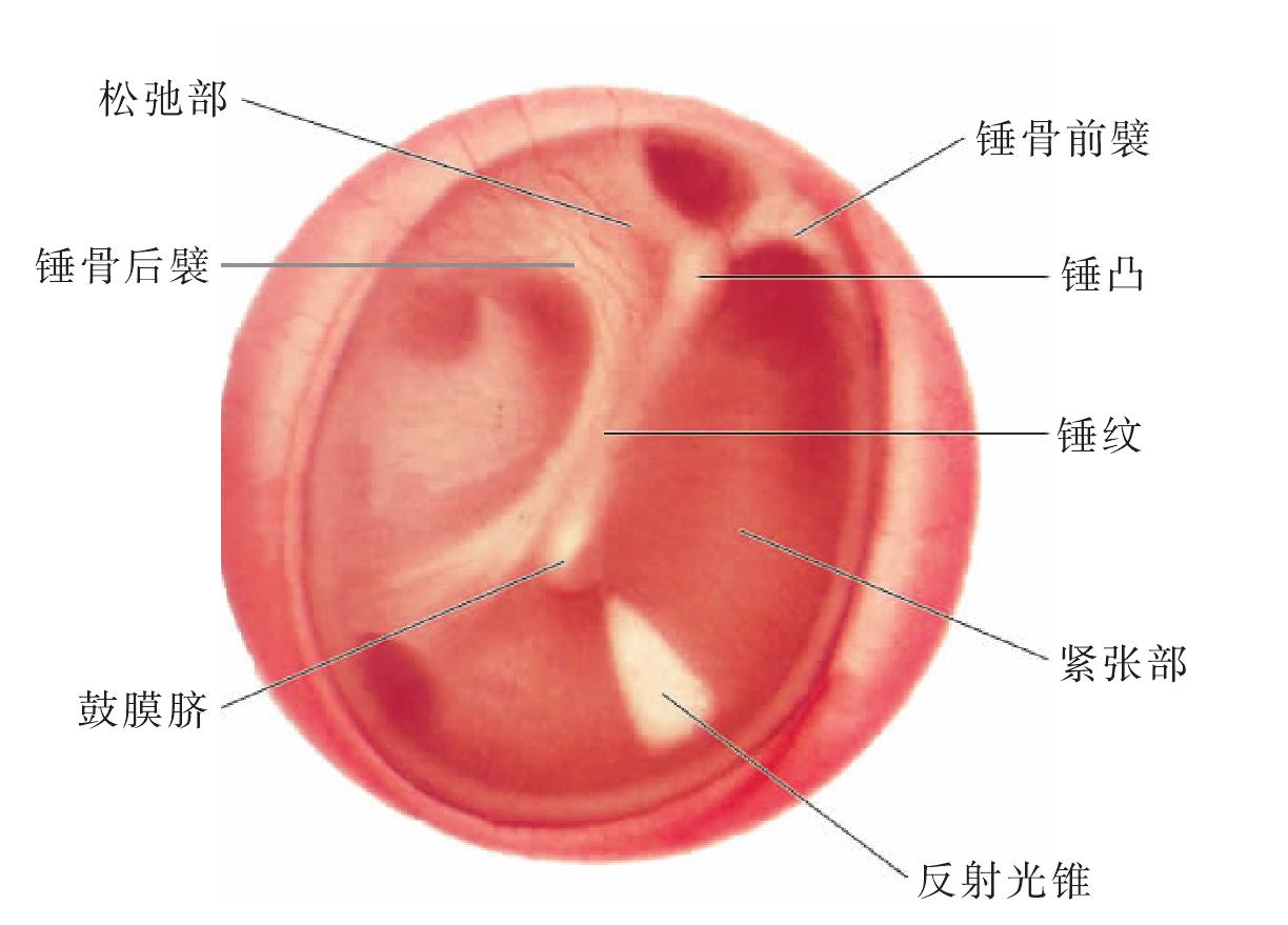 耳膜正常图片