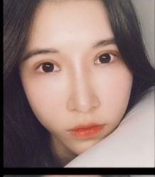 -大麦微针植发全国连锁