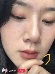 -倩极·精研痘敏肌管理