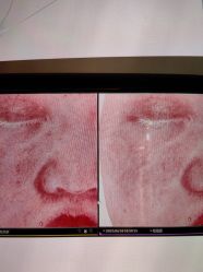 -苑苑vbeauty科技美容SPA