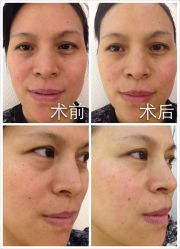 脸部抗衰-光SPA科技美肤