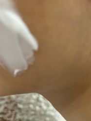 -美瑞莎创美医疗美容