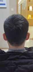 -大麦微针植发丨全国连锁