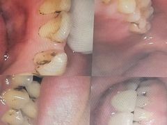 -好牙依口腔(开源店)