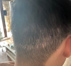 -熙朵美学植发·连锁品牌