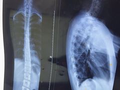 -张钰强中医正骨推拿连锁(华发商都店)