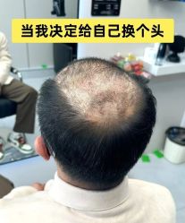 -唐风采假发补发定制