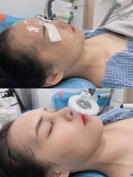 -慕颜医疗美容·皮肤微整 抗衰