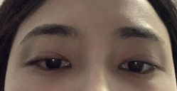 -素美医疗美容·西南眼鼻整形·修复基地