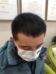 点击看大图 -熙朵美学植发连锁