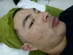 -荟草堂痘肌修护中心