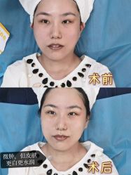 体验前-哈尔滨瑞丽医疗美容医院