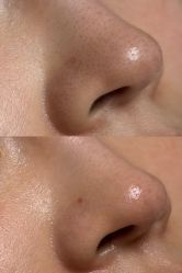 -美愈美肤MEIYU SKIN