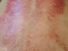 -臻余堂·艾灸·正骨