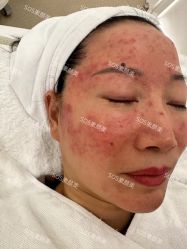 -SOS修丽可.痘肌修复中心