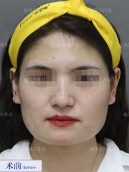 -圣嘉新医疗美容医院