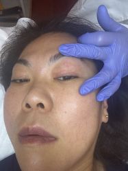 -清疣美疣·痣·斑净肤中心
