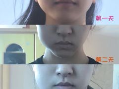 -团圆口腔·种植中心(锦江院区)