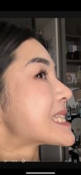 体验前-上海首尔丽格医疗美容医院