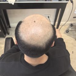 -唐风采假发补发定制