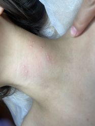 -清疣美疣·痣·斑净肤中心