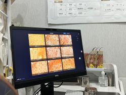 -悟空祛痘·诺奖技术专业店