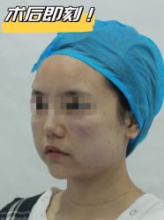 -素美医疗美容·西南眼鼻整形·修复基地