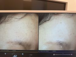 -苑苑vbeauty科技美容SPA