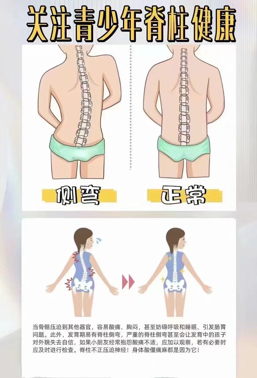 为什么会驼背