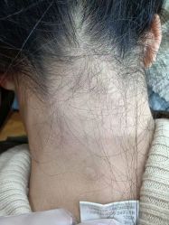 -美人痣全国连锁