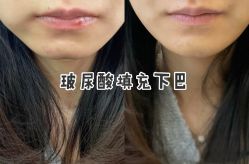 -上海漾颜医疗美容