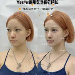 -深圳艺星医疗美容医院