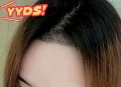 -大麦微针植发丨全国连锁