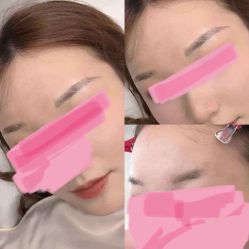 -久匠半永久纹眉