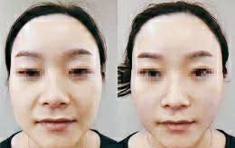 -SKINIST丽铂医疗美容
