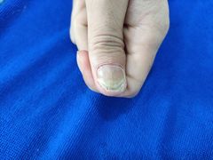 -世龙世家甲沟炎·灰指甲·嵌甲矫正·修脚(武侯区双楠店)