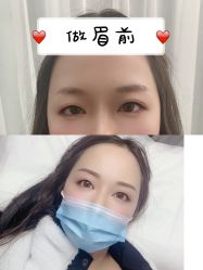 点击看大图 -变美丽半永久纹眉连锁·机器野生眉•洗眉