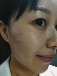 -深圳芙必优医疗美容·抗衰中心