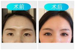-素美医疗美容·西南眼鼻整形·修复基地