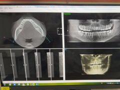 -土豆口腔(凤凰北总店)