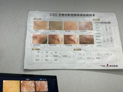 -悟空祛痘·诺奖技术专业店