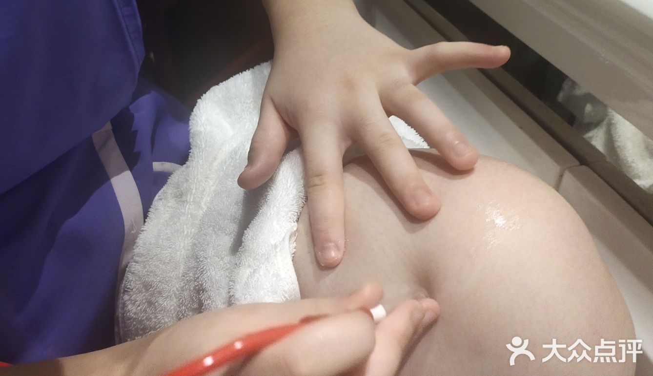 是我们店非常受欢迎的一个面部项目！