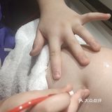 是我们店非常受欢迎的一个面部项目！