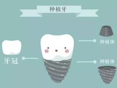 -团圆口腔·种植中心(锦江院区)