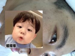 -痘博士北京·全国连锁祛痘机构