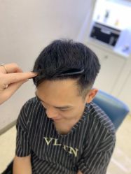 点击看大图 -大麦微针植发丨全国连锁