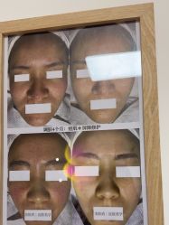 -美肤盾祛痘·问题肌头疗管理中心