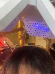 -碧莲盛·不剃发植发